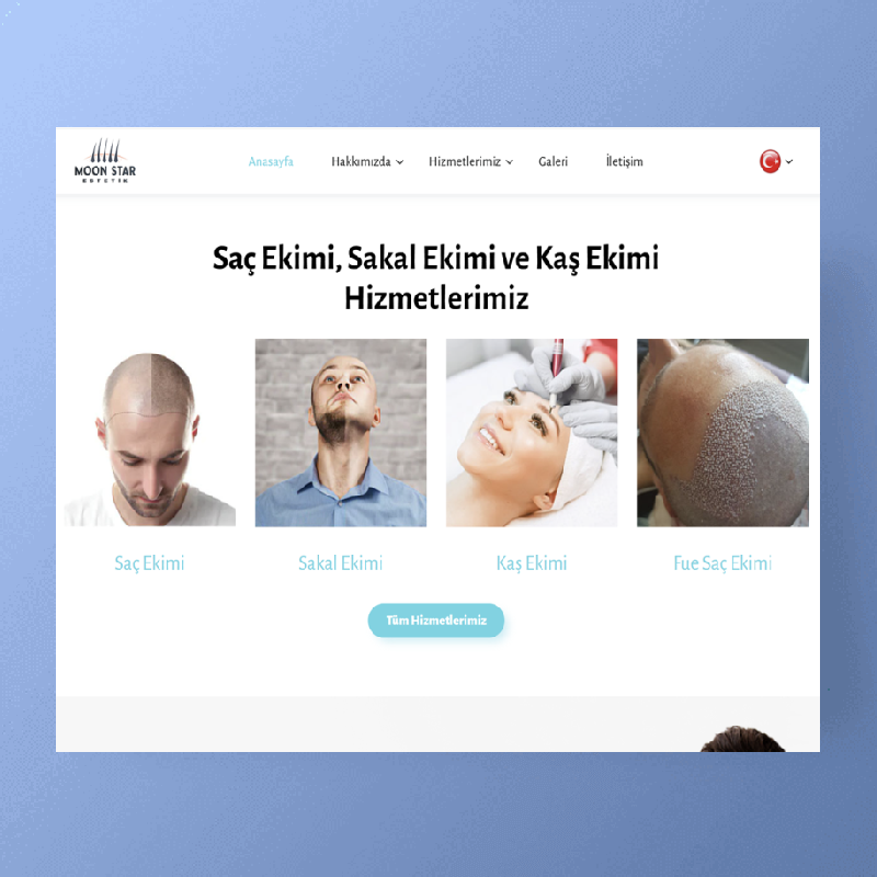 Moon Star Saç Ekimi Yerel İşletme Web Sitesi Görseli